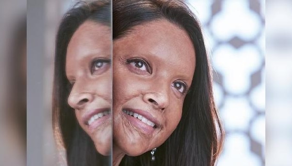 Hope we won't have to constantly tell stories on acid attack survivors to see change: Deepika