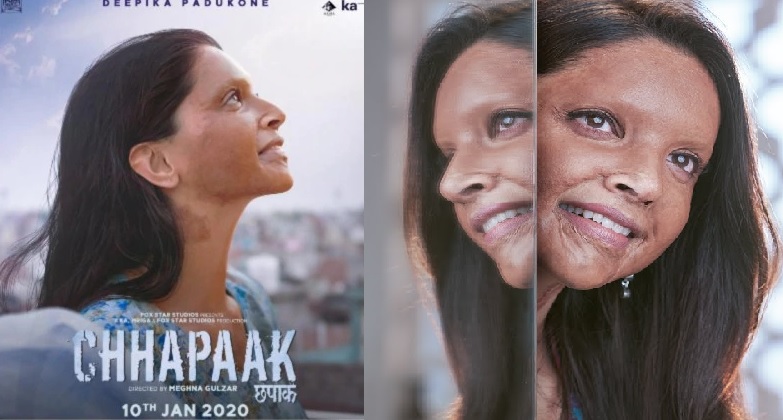 HC directs 'Chhapaak' makers to give credit to acid attack survivor's lawyer for inputs to film